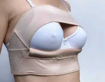 a woman wearing a support bra after undergoing a surgical breast procedure/