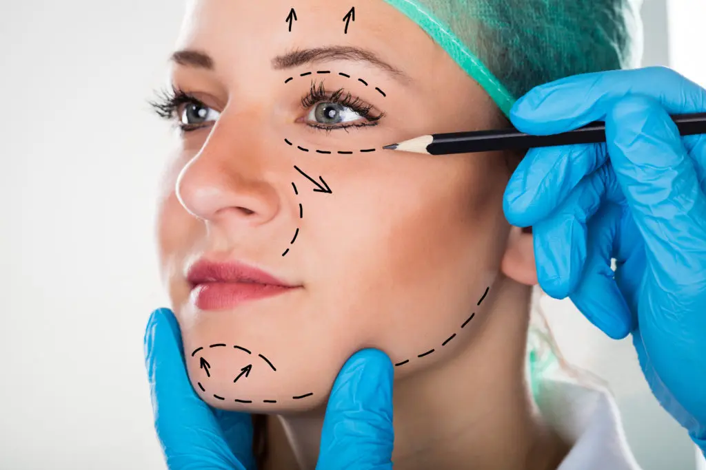 A plastic surgeon drawing surgery guidelines on a woman's face