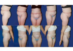 1936 imageset 1 before